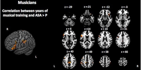 music learning benefits children's memory and attention